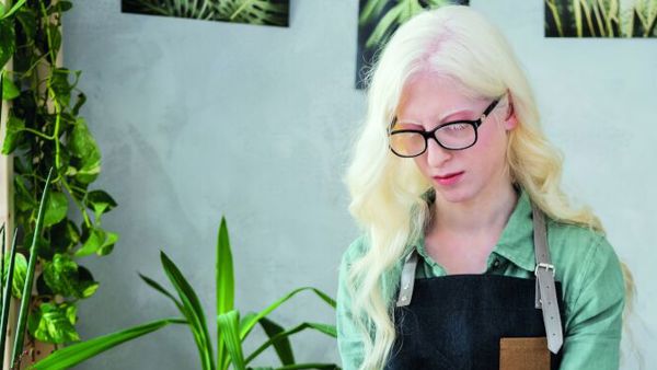 Vrouw met albinisme is aan het bloemschikken Vrouw met albinisme is aan het bloemschikken