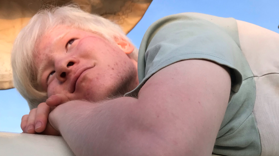 Een foto van Jing. Hij ligt met zijn hoofd op zijn armen en kijkt weg van de camera. 